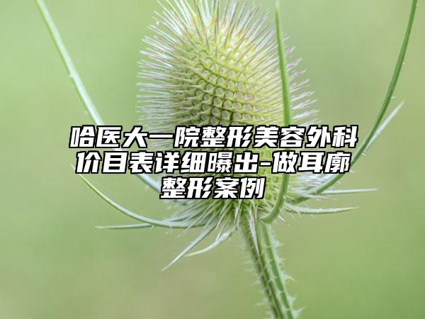 哈医大一院整形美容外科价目表详细曝出-做耳廓整形案例