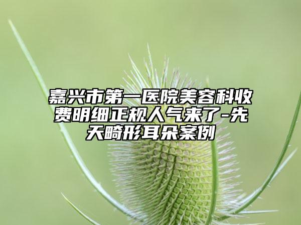 嘉兴市第一医院美容科收费明细正规人气来了-先天畸形耳朵案例