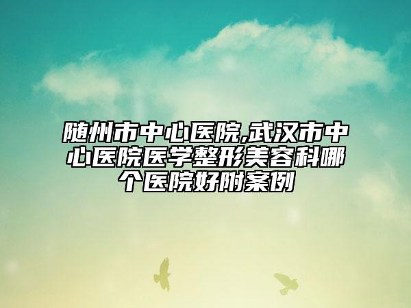 随州市中心医院,武汉市中心医院医学整形美容科哪个医院好附案例