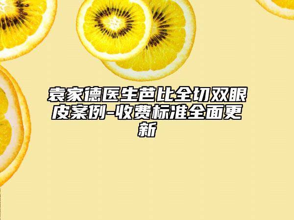 袁家德医生芭比全切双眼皮案例-收费标准全面更新
