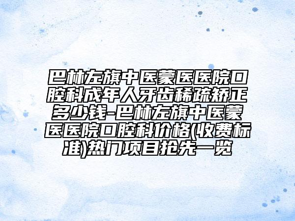 巴林左旗中医蒙医医院口腔科成年人牙齿稀疏矫正多少钱-巴林左旗中医蒙医医院口腔科价格(收费标准)热门项目抢先一览